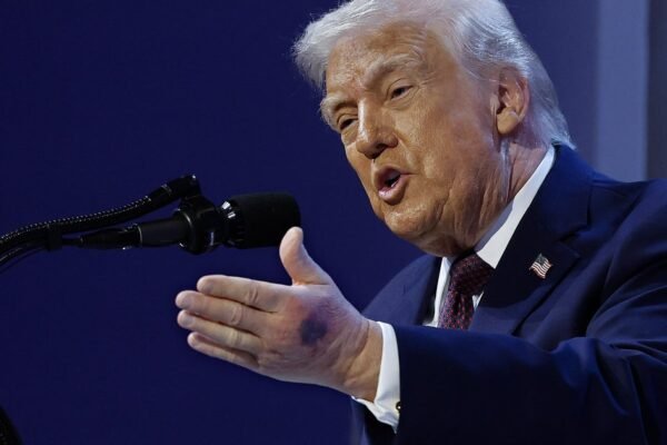 Karoline Leavitt Gave A Reason For Donald Trump’s New Hand Bruise — There’s Just 1 Problem