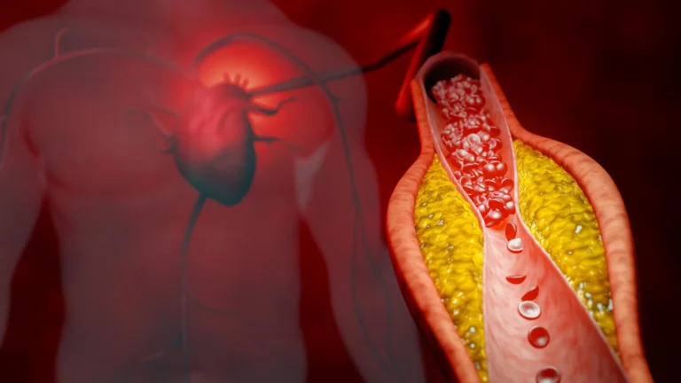 New treatment cuts bad cholesterol by nearly 50% without statins