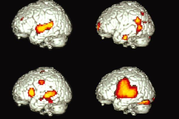 How Does One Brain Speak Two Languages?