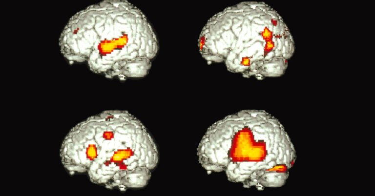 How Does One Brain Speak Two Languages?