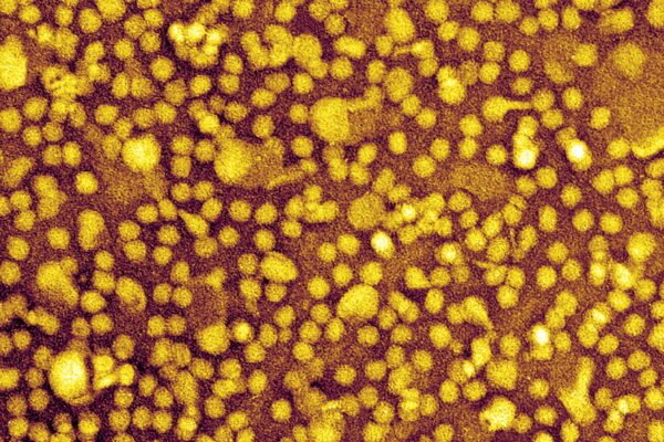 One-and-Done Heart Disease Prevention? Scientists Show It May Be Possible.