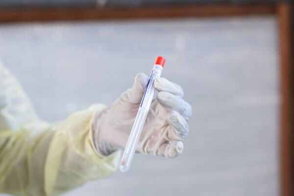 Scientist Charged With Conspiring to Smuggle Mpox Virus Into U.S.