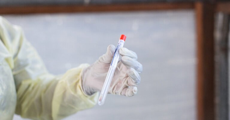 Scientist Charged With Conspiring to Smuggle Mpox Virus Into U.S.