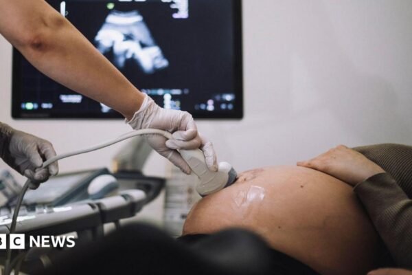 'Normal birth drive' criticism removed from maternity report, expert claims