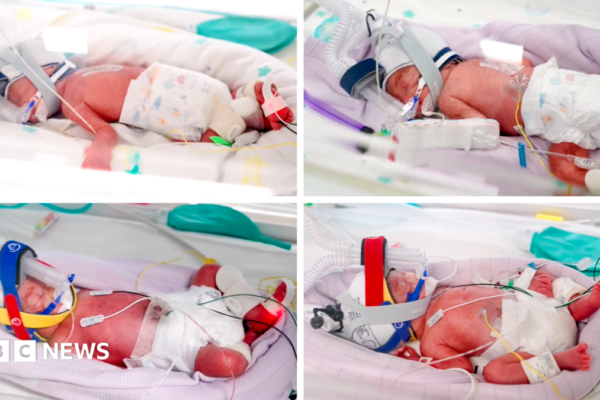 Rare identical quadruplets born in Australia