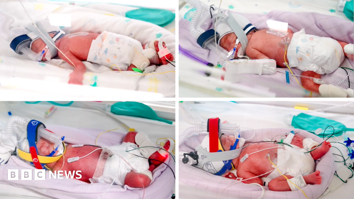 Rare identical quadruplets born in Australia