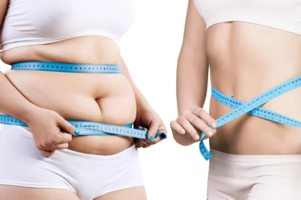 Scientists discover a protein switch that burns fat and blocks new fat cells