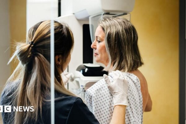 Breast cancer checks missing most women under 50 who are at risk, says study