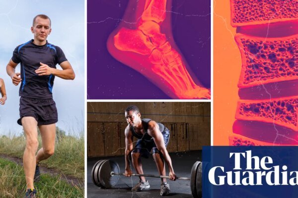 ‘I spent a week crying. I’ve never had an injury in my life!’ Why do so many fitness fans end up needing surgery?